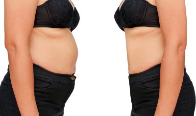 Woman weight loss before and after