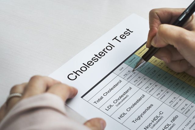 Cholesterol test