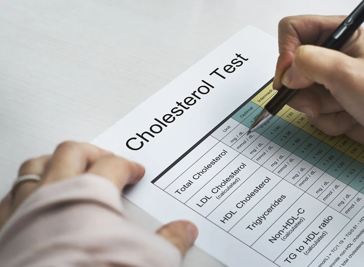 Cholesterol test