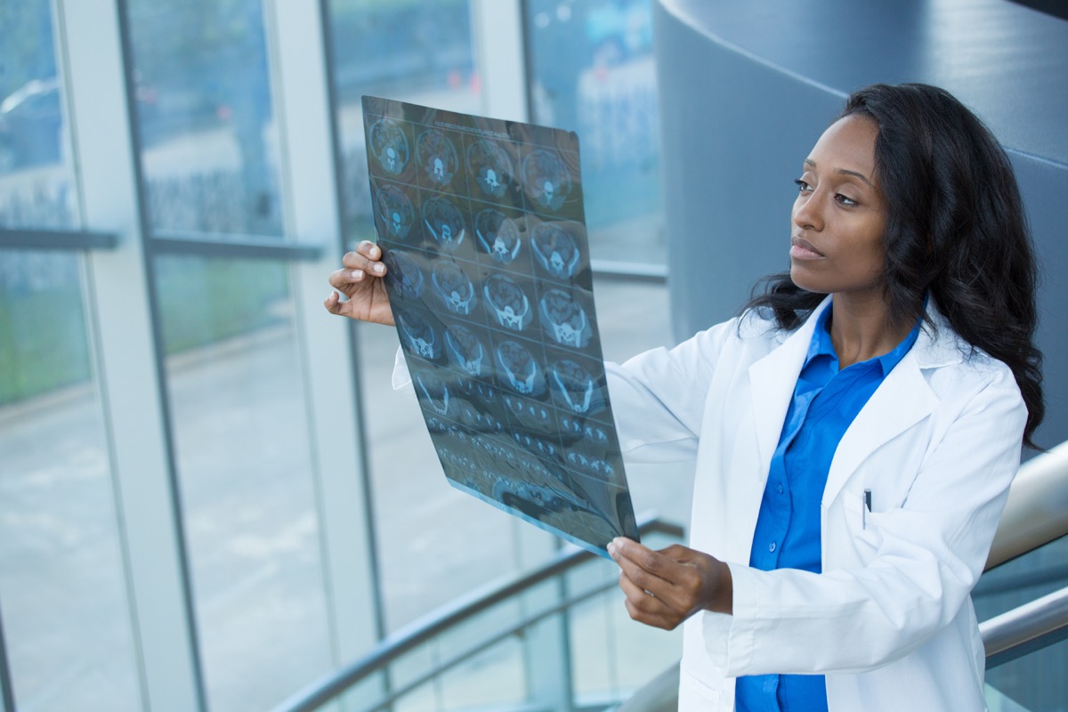 Closeup portrait of intellectual woman healthcare personnel with white labcoat, looking at full body x-ray radiographic image, ct scan, mri