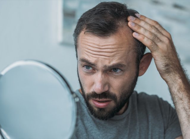 man with hair loss looking at mirror