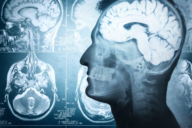 image of a man from side profile showing brain
