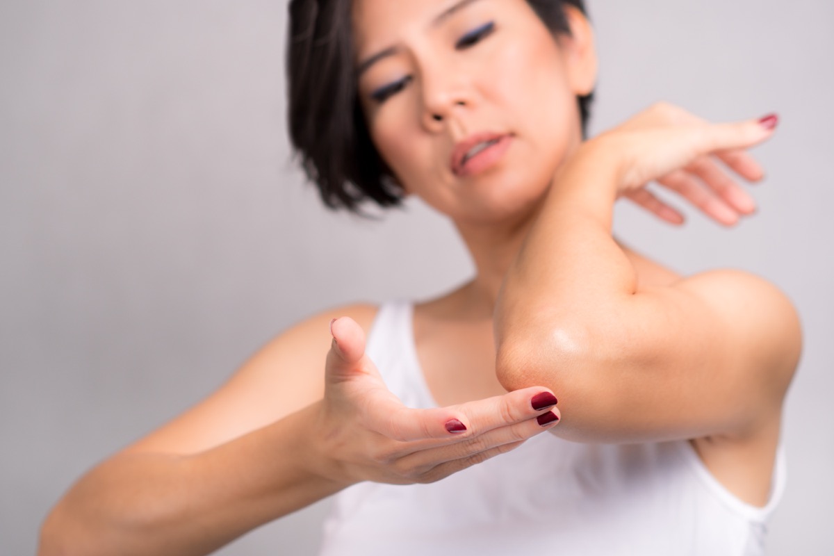 woman applying daily skin care lotion, moisturizer cream, on her elbow. Rough and dry skin