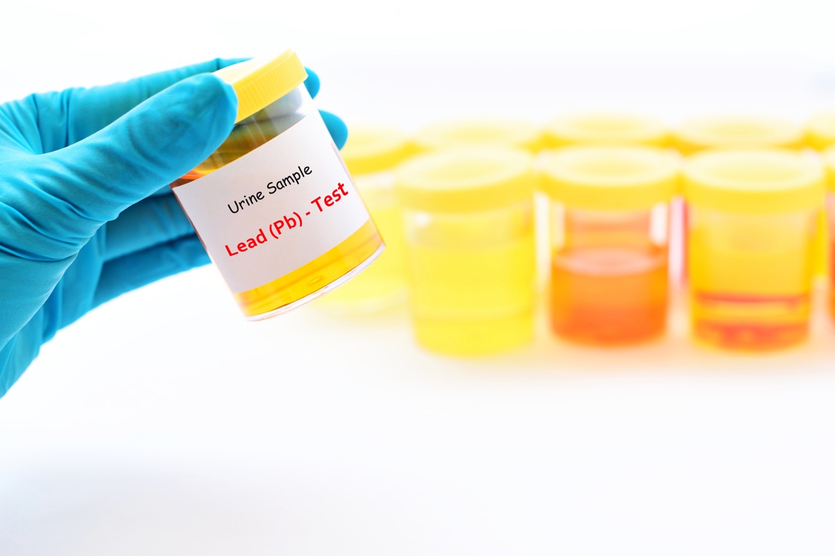 scientist holds a lead test