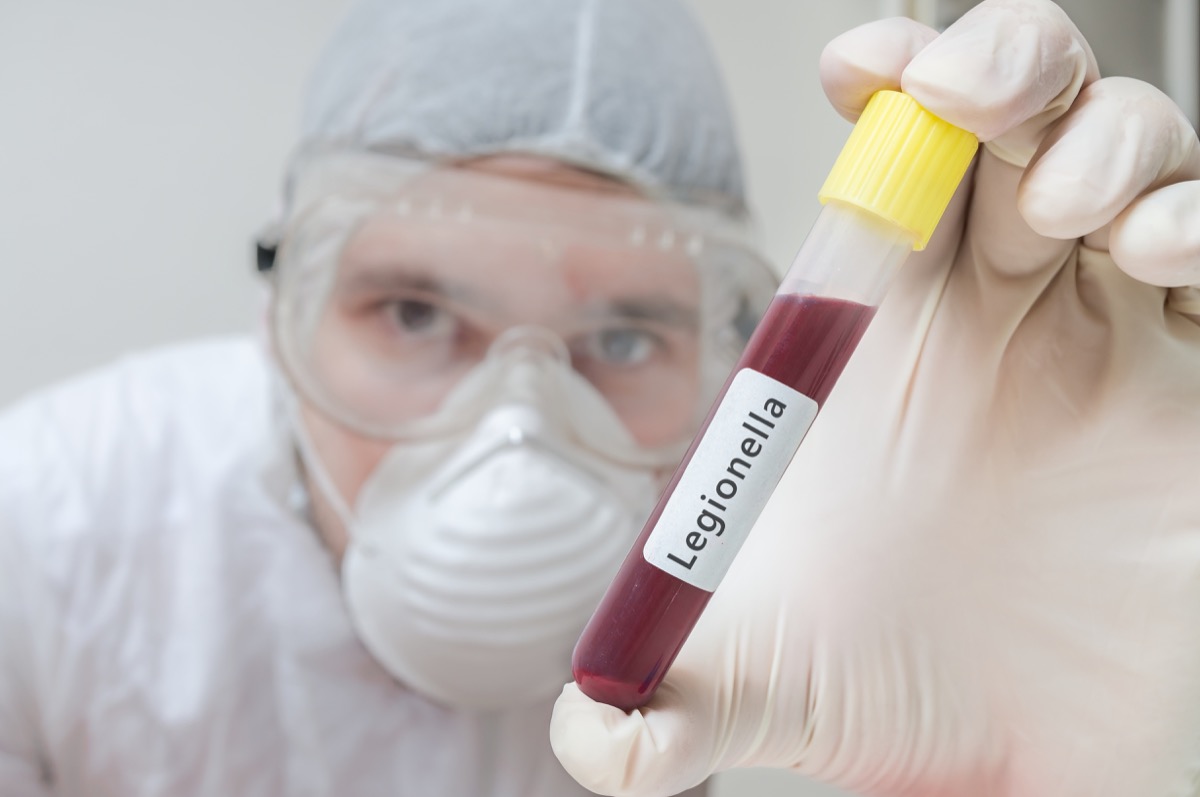 Researcher in laboratory holds test tube with Legionella blood sample