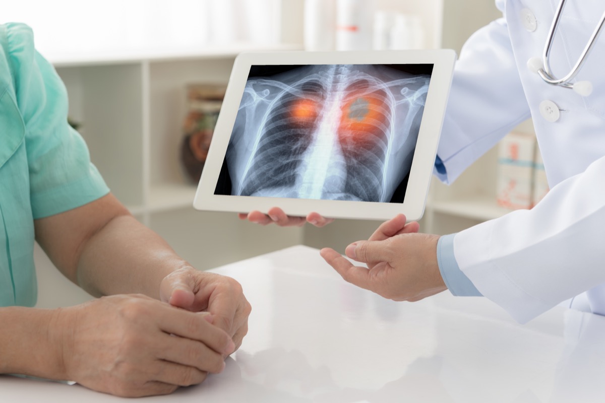 doctor explaining results of lung check up from x-ray scan chest on digital tablet screen to patient