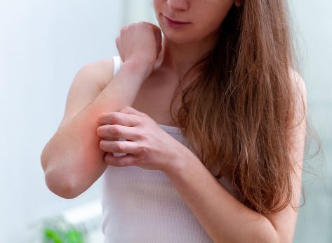 The Best & Worst Foods for Eczema