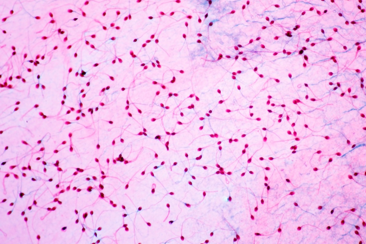 Sperm seen under a microscope