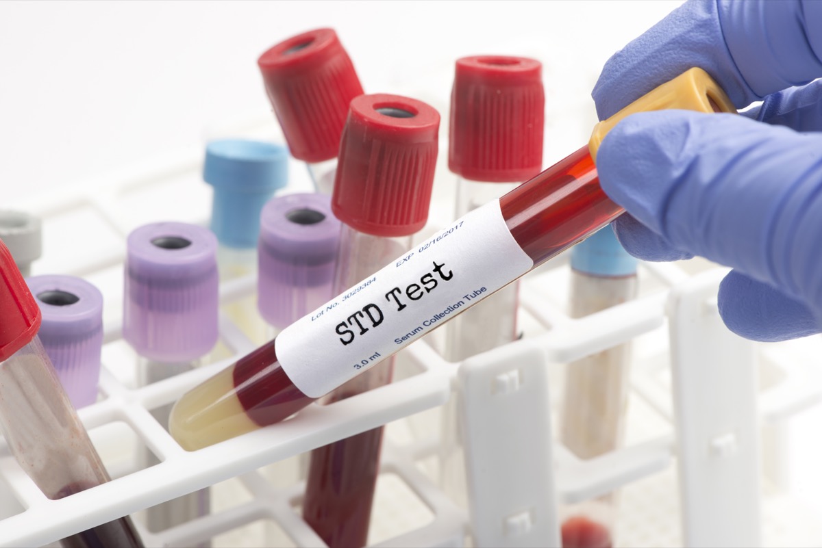 STD test blood analysis collection tube selected by technician