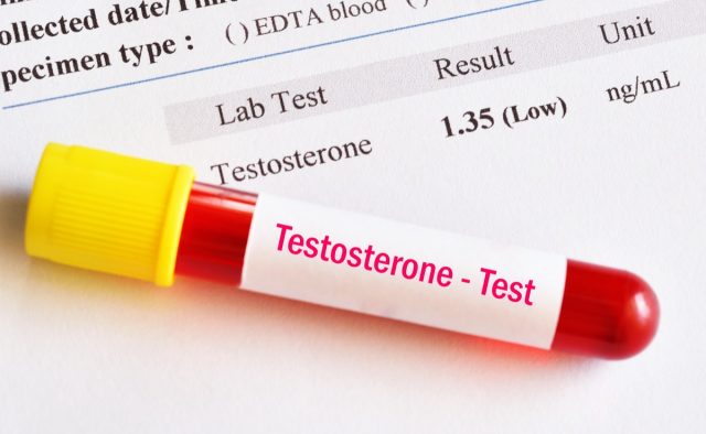 testosterone hormone test result with blood sample tube