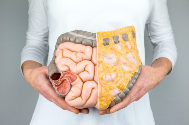 Woman holding model of human intestines in front of body.