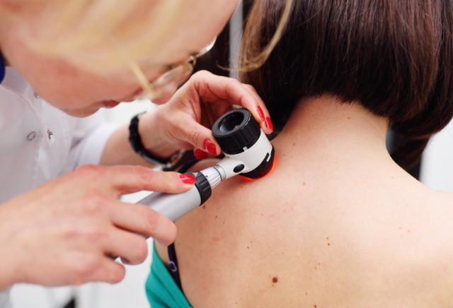 The dermatologist examines the moles or acne of the patient with a dermatoscope. Prevention of melanoma