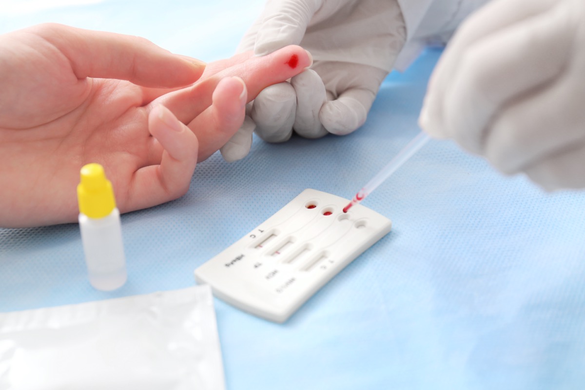 Doctor using test for HIV, Hepatitis B, C and Syphilis
