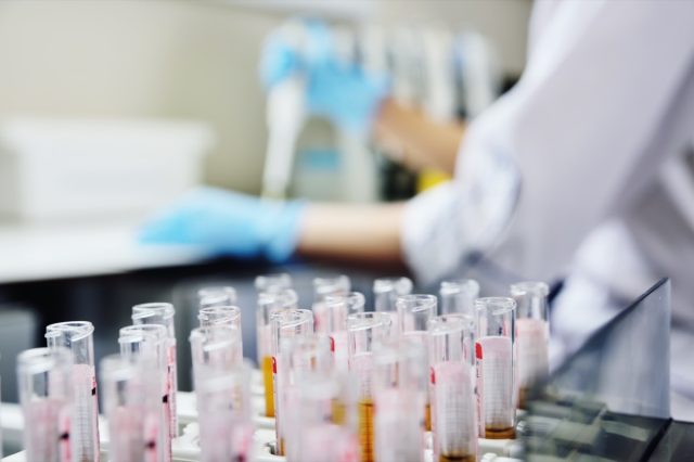 A scientist in a medical laboratory with a dispenser in his hands is doing an analysis