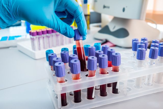 Medizinische Ausrüstung.  Bluttest