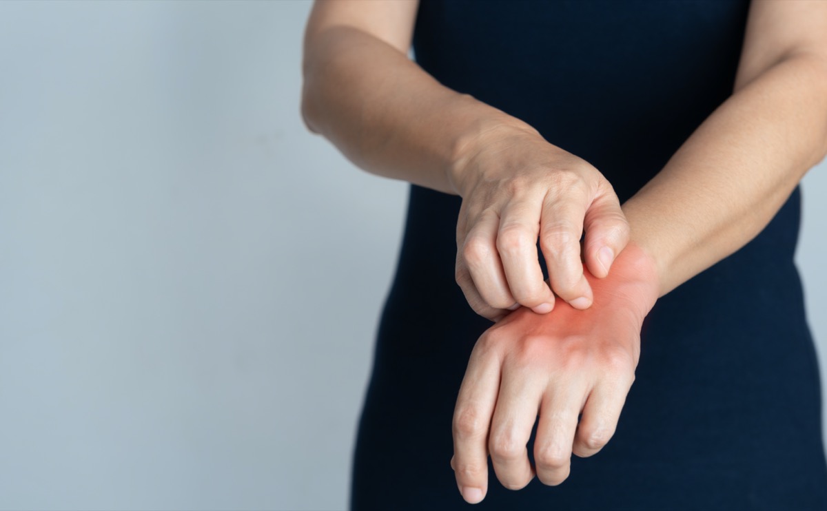 Itching of skin diseases in women using the hand-scratching