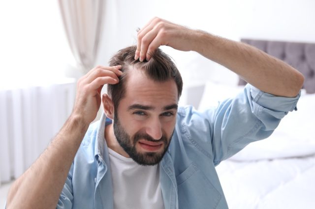 man with hair loss problem indoors