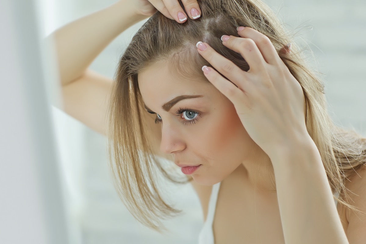 10 Best Diet Tips to Prevent Hair Loss