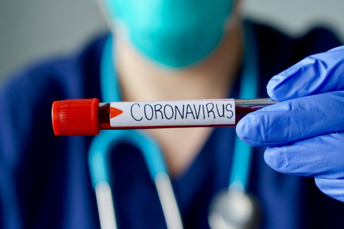 Nurse wearing respirator mask holding a positive blood test result for the new rapidly spreading Coronavirus