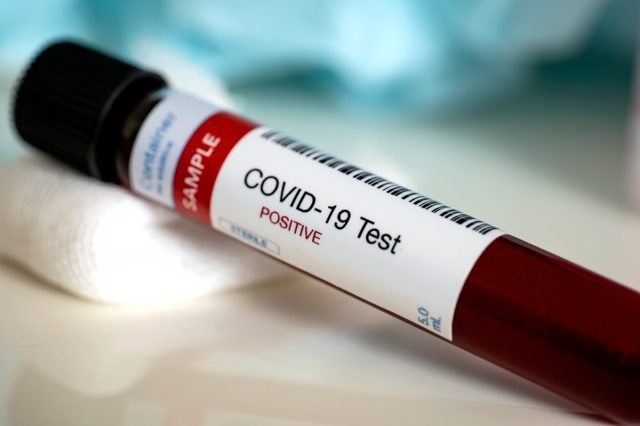 Blood test samples for presence of coronavirus