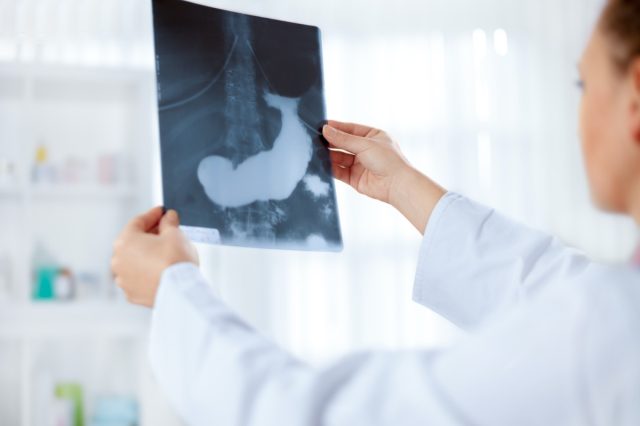 Médecin examine une image radiographique du pancréas