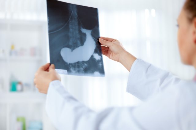 doctor examines x-ray of pancreas