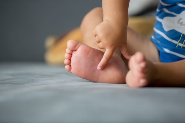 Children feet, sting by a bee, summertime