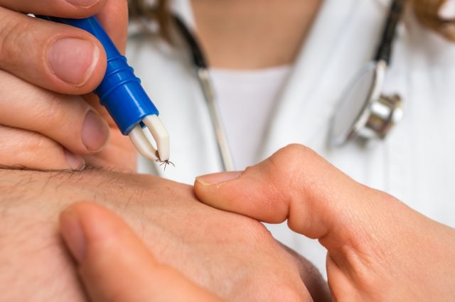 Female doctor removing a tick with tweezers from hand of patient