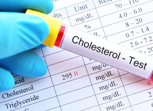 high cholesterol