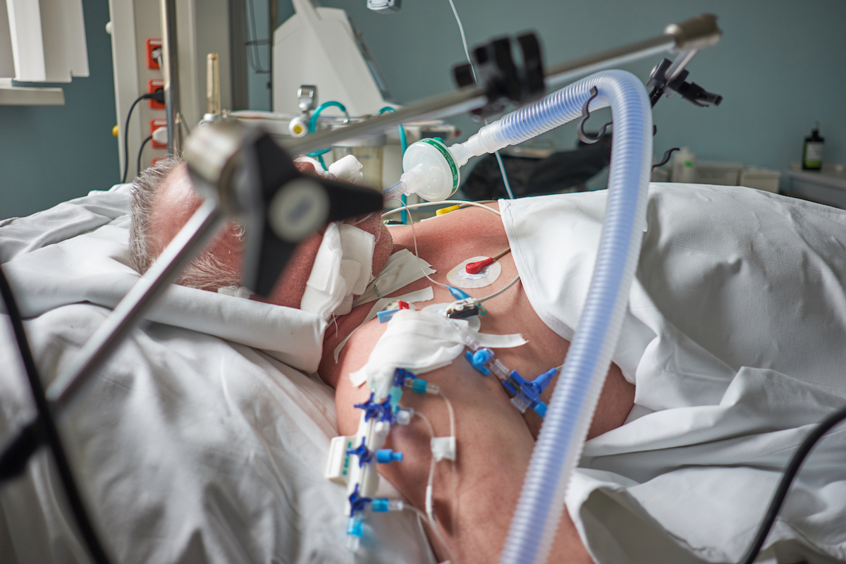 image of man on a ventilator