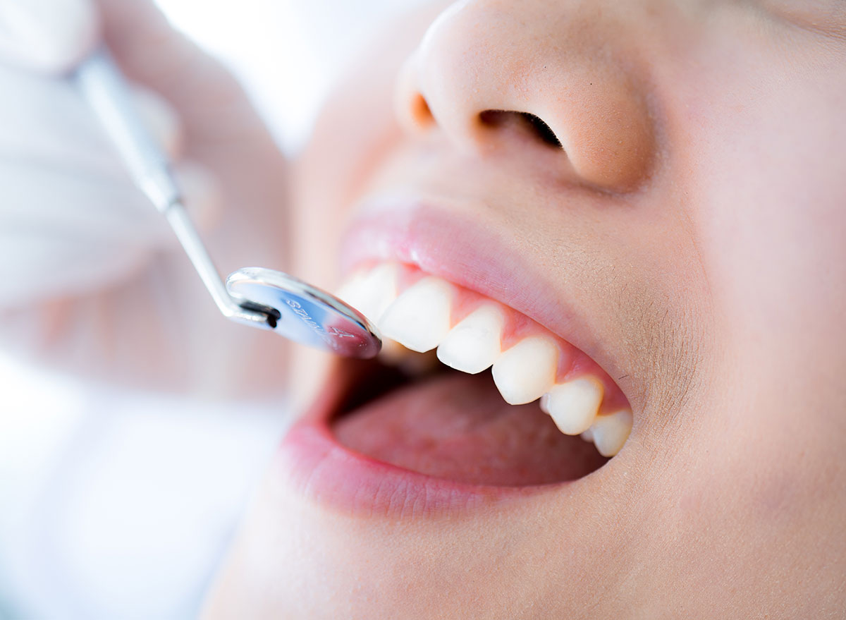 4 Surprising Effects of Chewing Gum, Says Dietitian — Eat This Not That