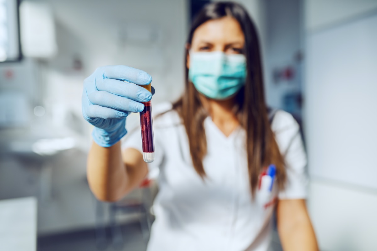 lab assistant holding test tube with blood while standing in