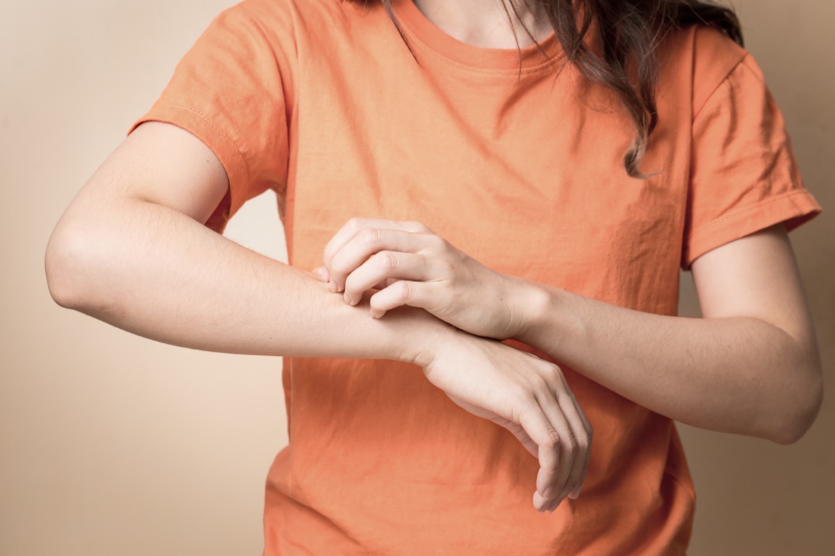 Women scratch itchy arm with hand.