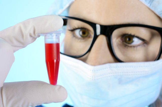 Scientist, doctor or researcher in the laboratory with blood test in reaction vessel for examination and evaluation