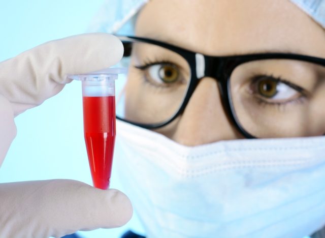 Scientist, doctor or researcher in the laboratory with blood test in reaction vessel for examination and evaluation