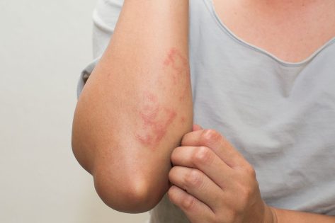 9 Warning Signs You're Actually Gluten Intolerant