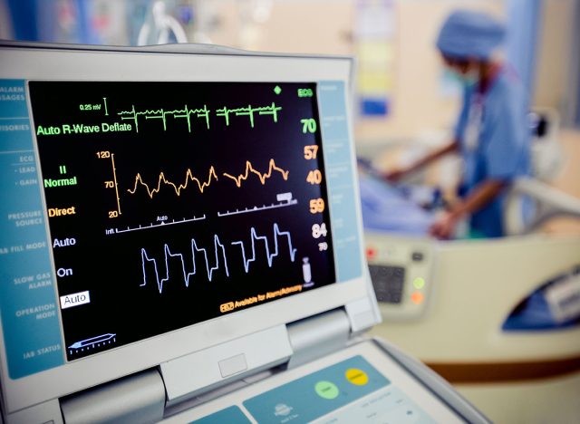 ekg test