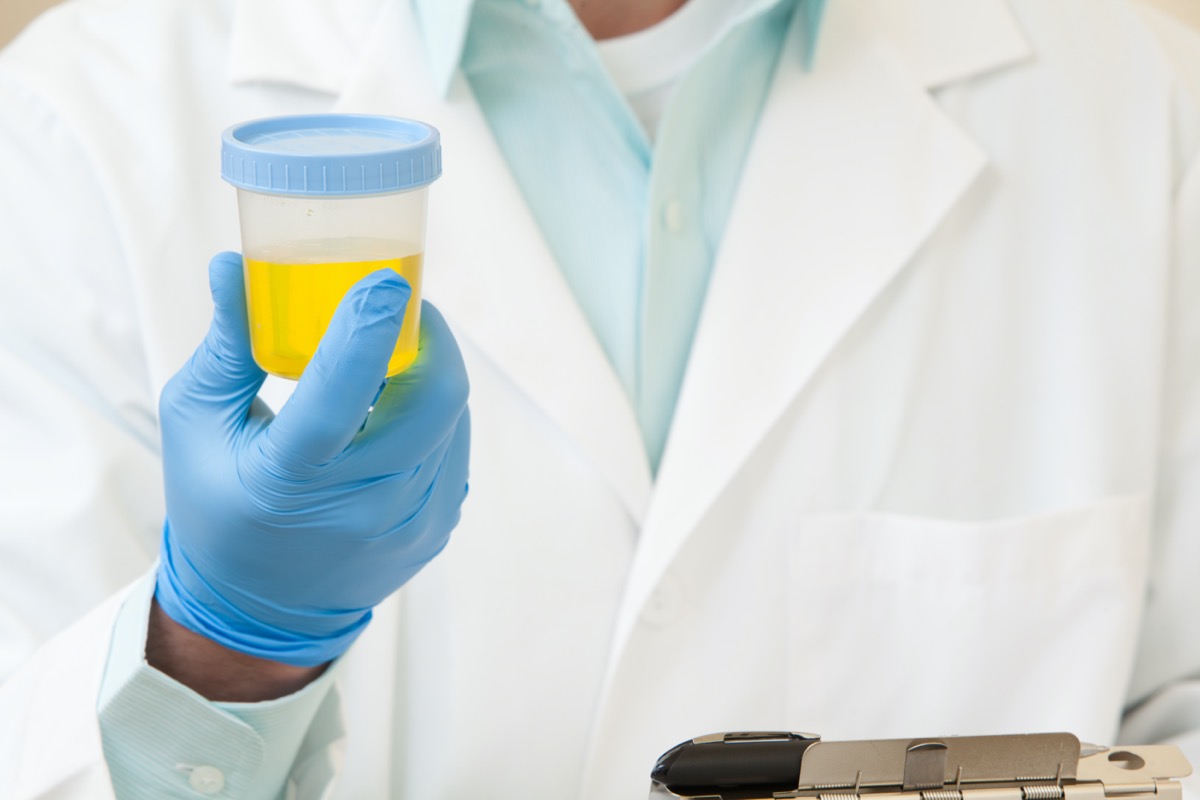 A doctor holding a urine sample