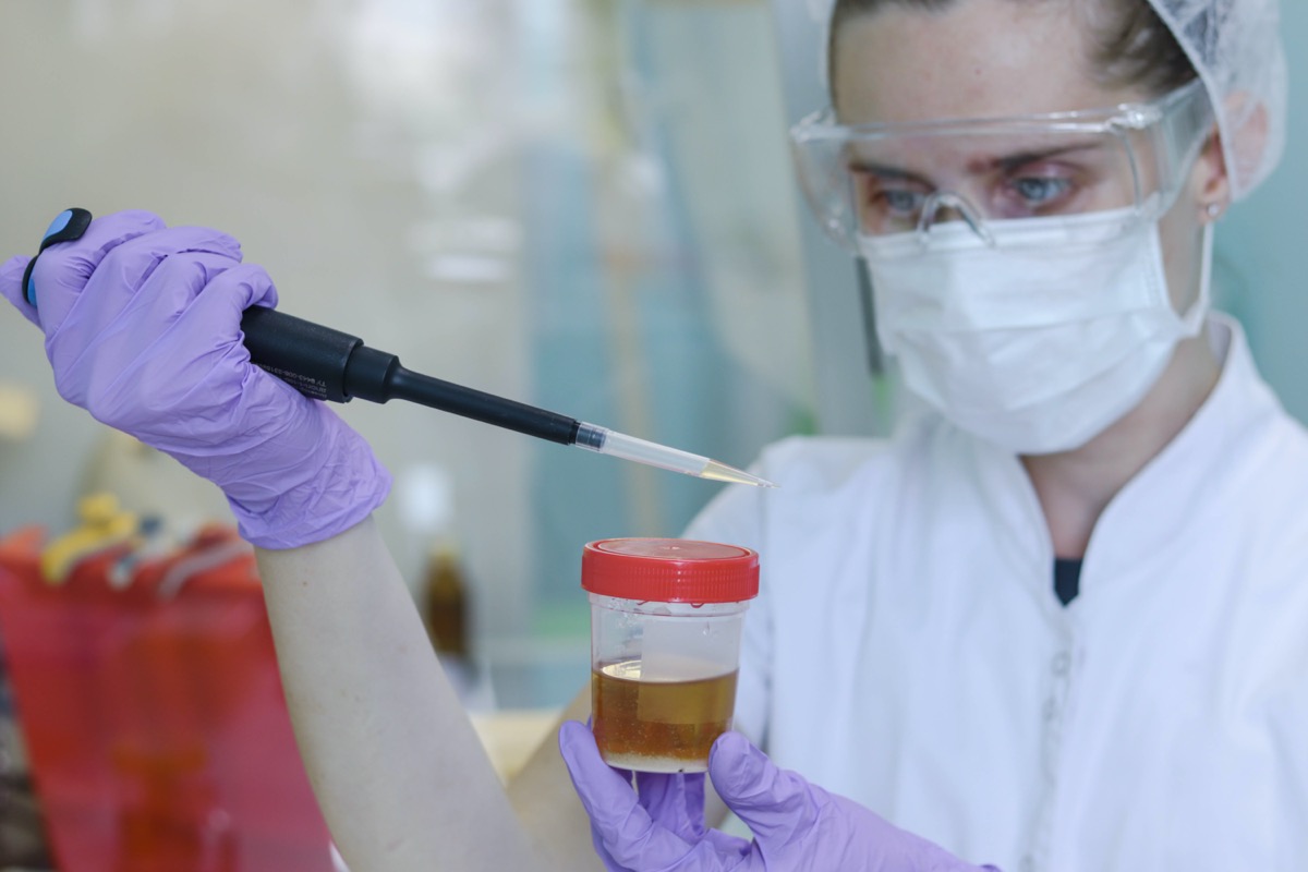A female doctor tests urine for infections and various substances