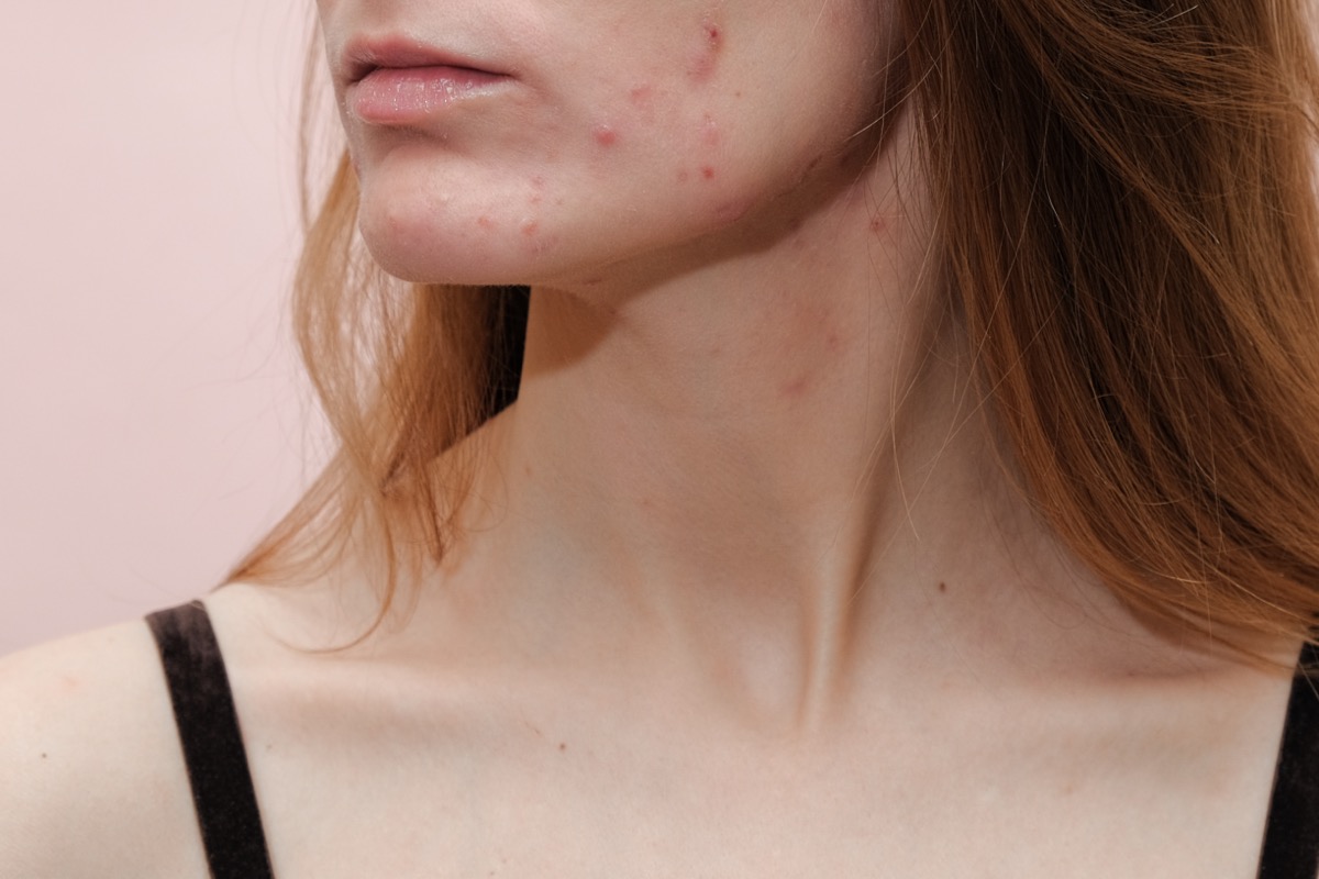 Woman with problem skin