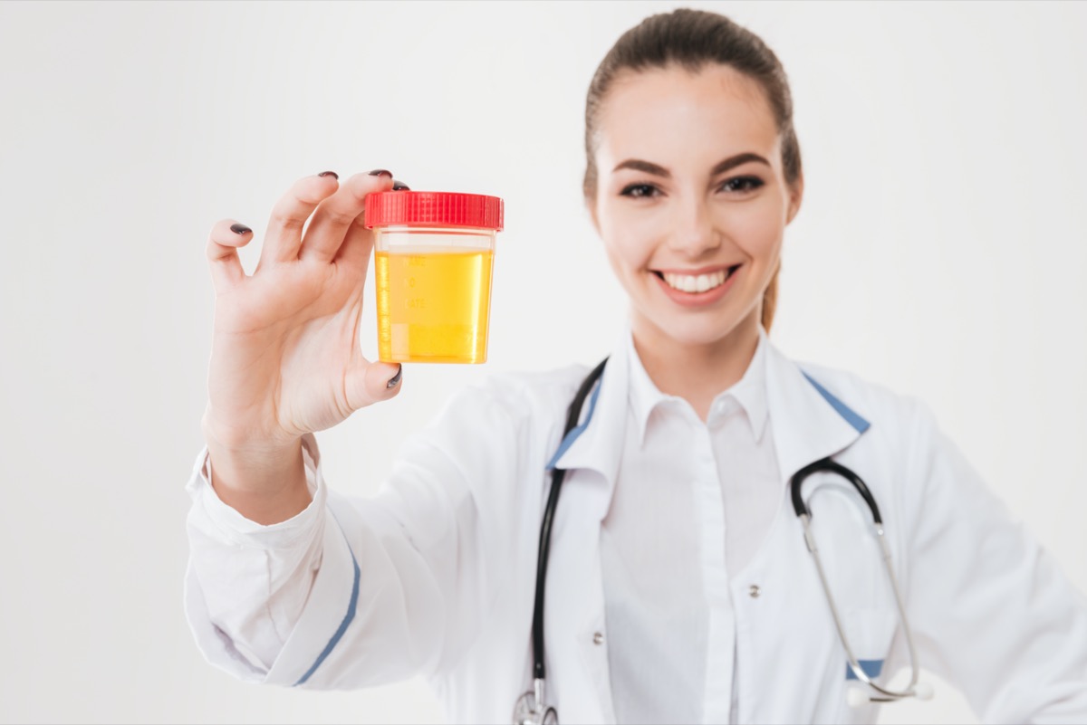 woman doctor standing and holding bottle of urine sample