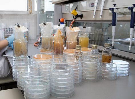 4 Foods That Are Proven Coronavirus Carriers