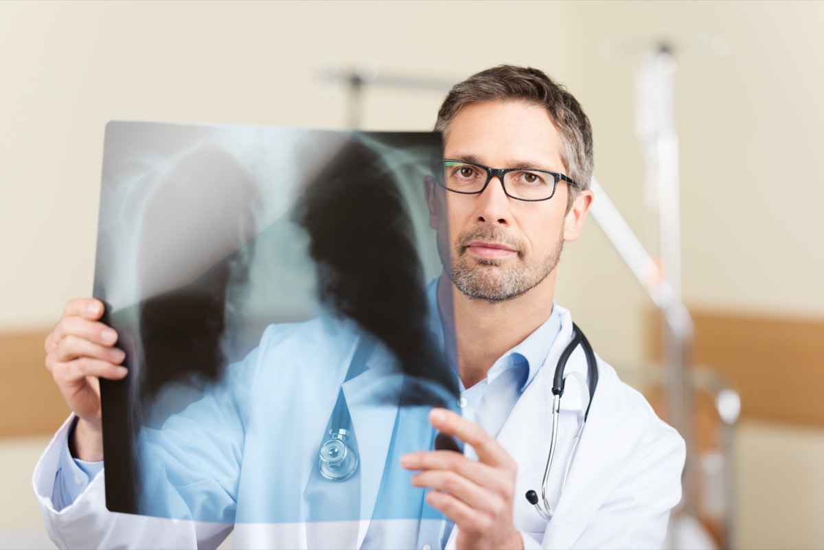 Portrait of serious mature doctor holding X-ray report in hospital