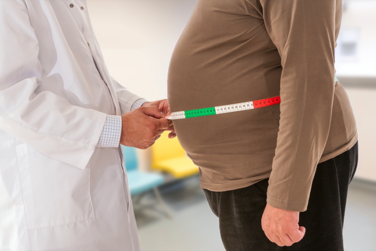 Doctor measuring body fat from waist of obese man.