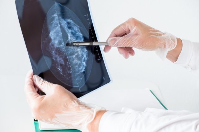 Female doctor analyzing mammography results on x-ray.
