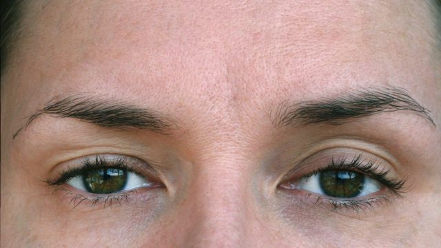 One Major Side Effect Of Getting Botox Says Dermatologist Eat This Not That