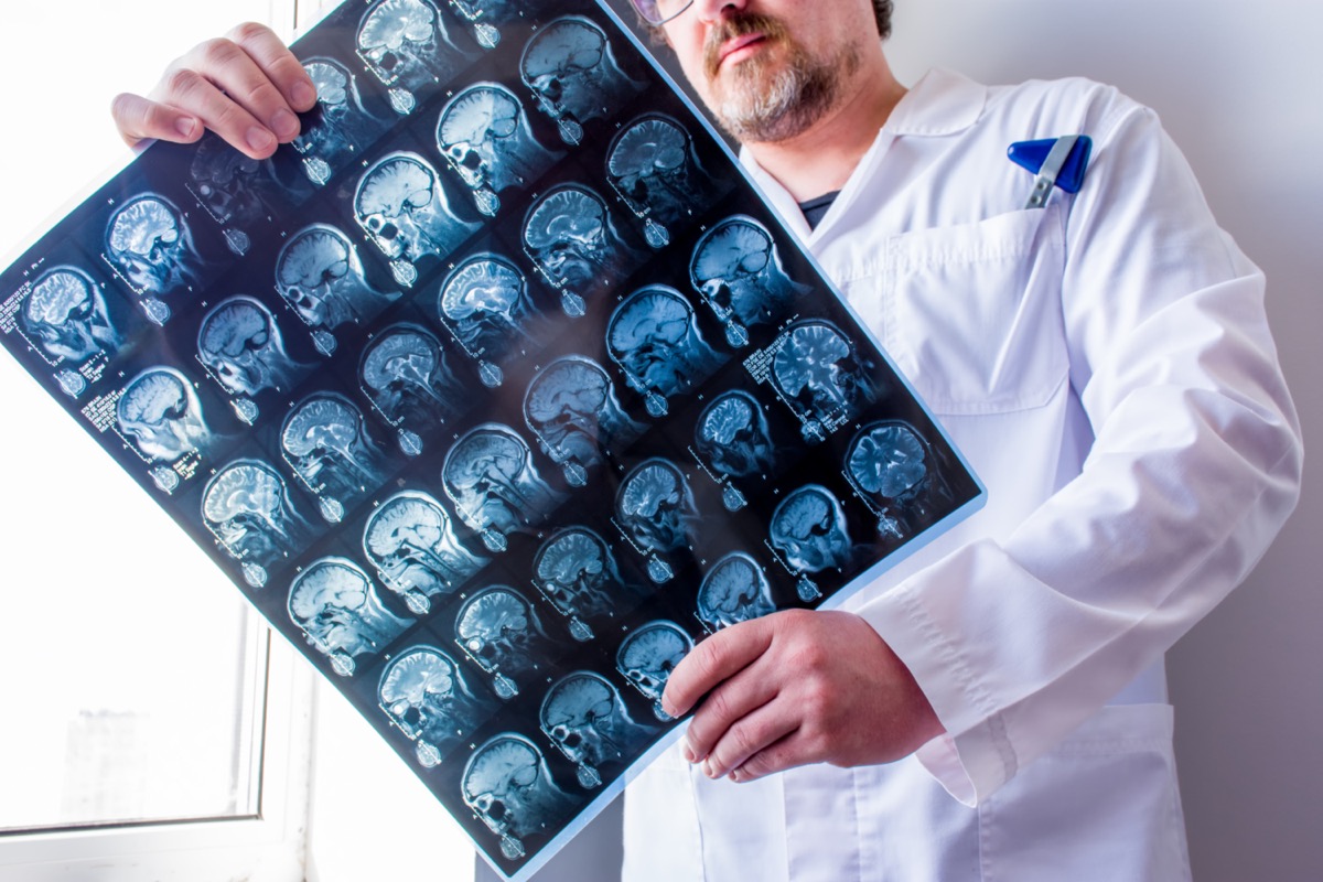 Doctor examines MRI scan of head, neck and brain of patient