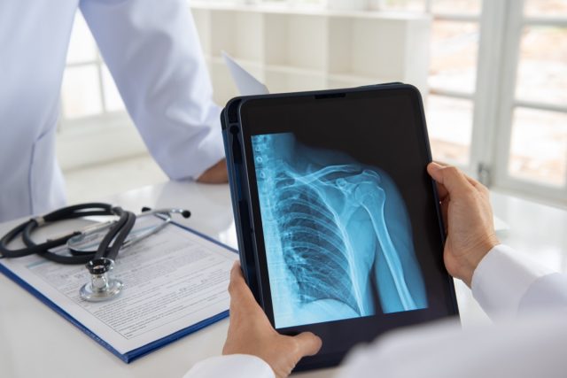 Doctor checks shoulder joint x-ray image on digital tablet