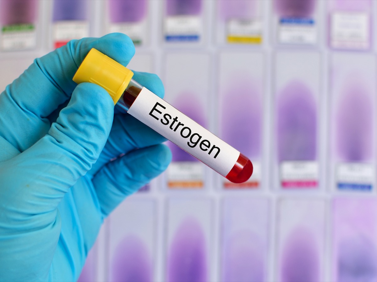 Blood sample for estrogen testing.