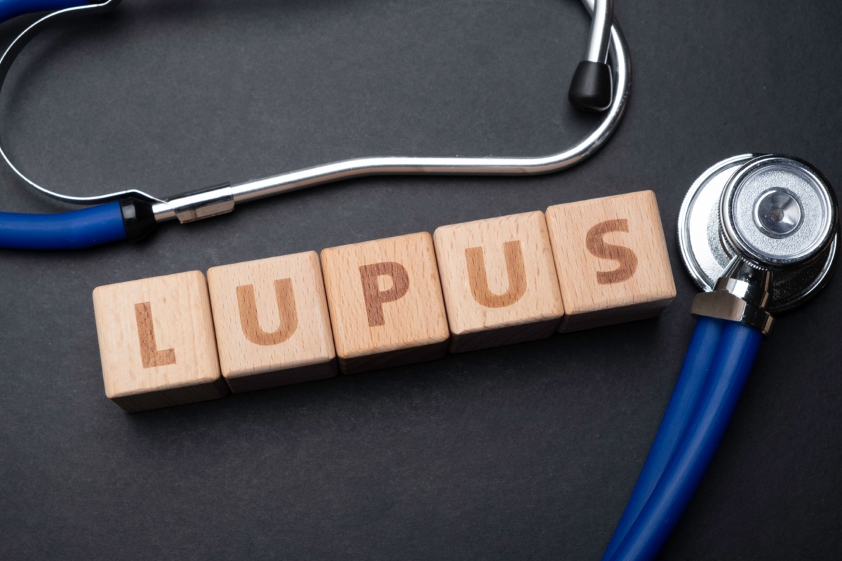 Wooden block form the word LUPUS with stethoscope